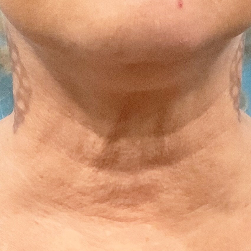 After Image